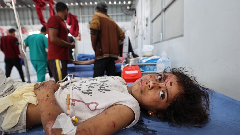 A wounded girl receives treatment at Al Awda Hospital at the Nuseirat refugee camp in the central Gaza Strip following an Israeli airstrike that hit a school in the camp on May 19 2025 afp