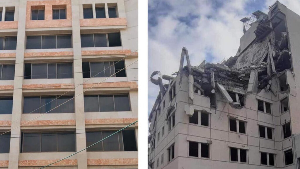 my home before and after
